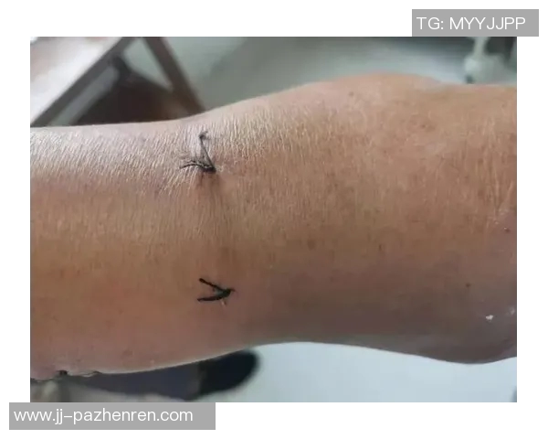 乔治左膝关节镜手术后重生：训练营前的全面评估与新起点